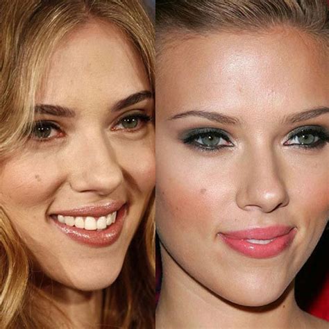 Saying NO to a Nose Job: 4 Celebrities Who .